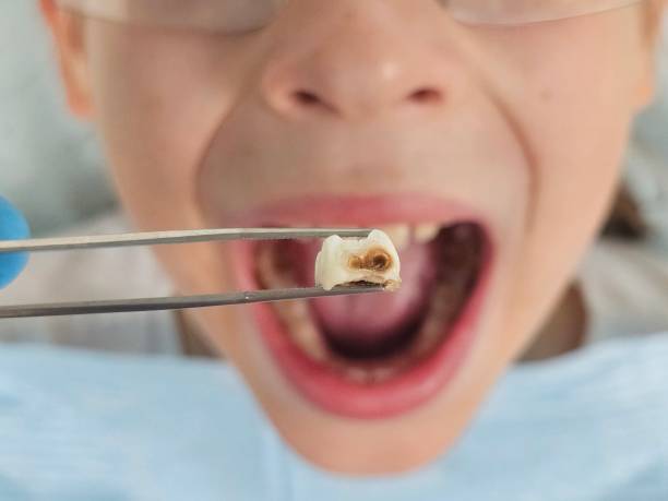 Best Orthodontic Emergency Dentist in De Soto, IL